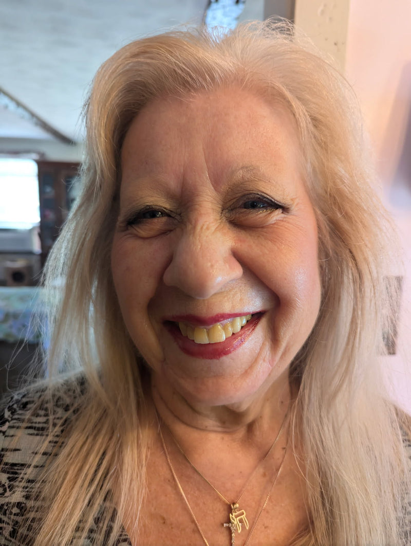 After - Barb after Greska's Face Serum.