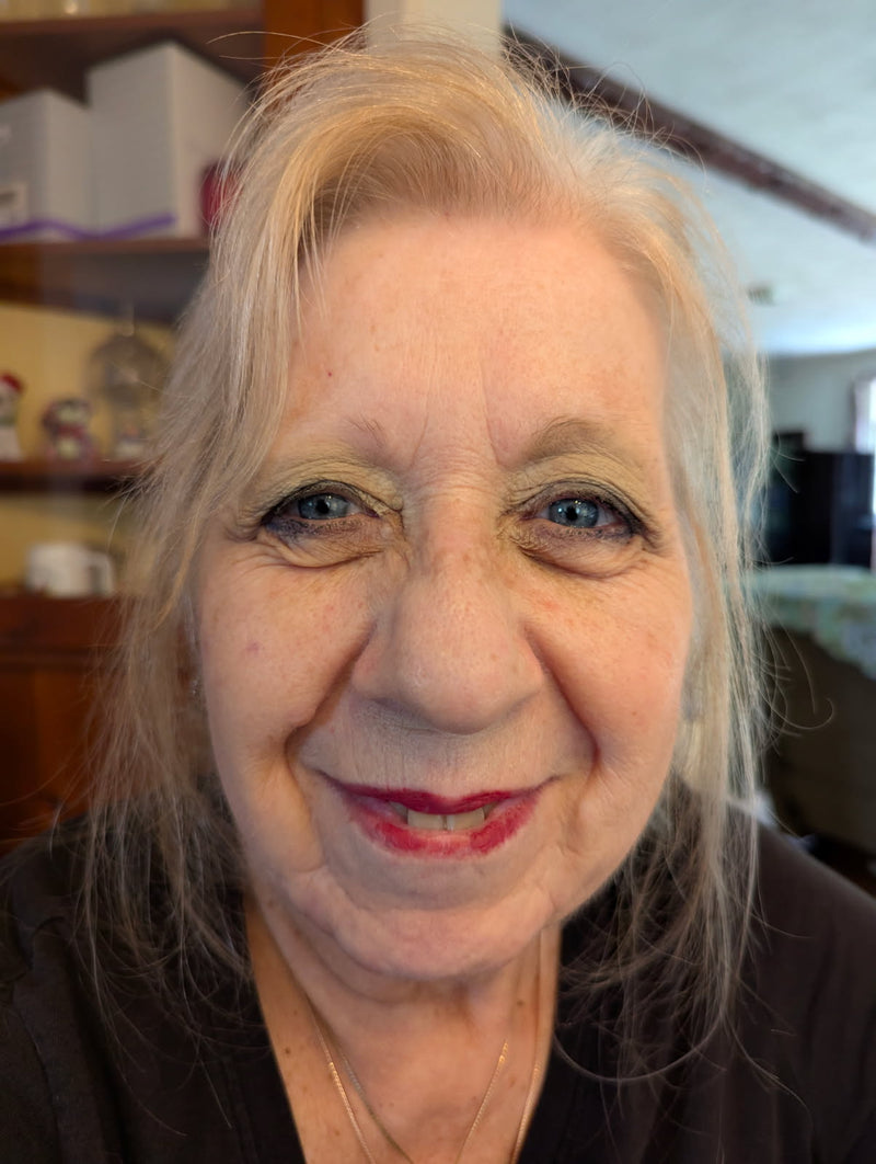 Before - Barb after Greska's Face Serum.