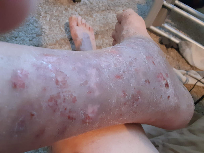 Before - glyphosate exposure before and after 30 days of...